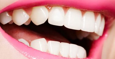 How To Remove Tartar Buildup from teeth