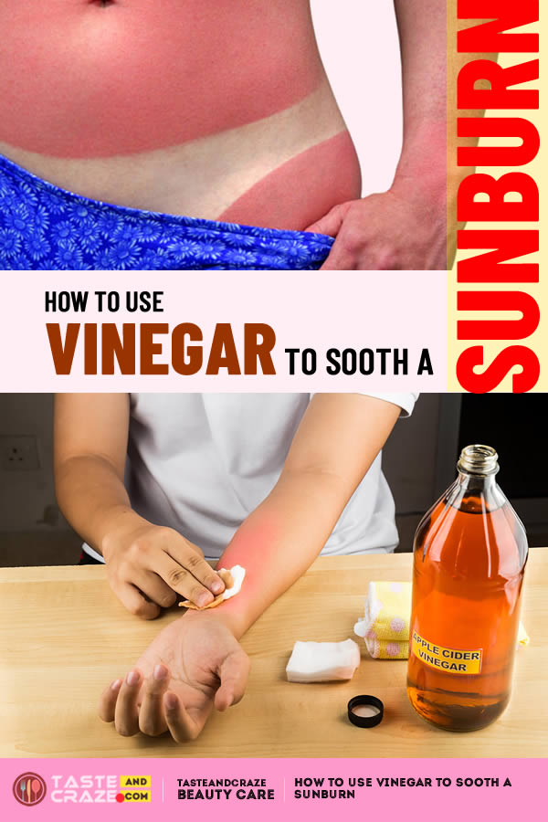 How to use Vinegar to Sooth a Sunburn • TasteAndCraze